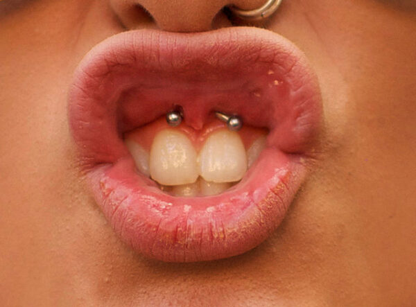 How to clean and maintain your smiley piercing